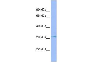 WB Suggested Anti-Lhpp Antibody Titration: 1. (LHPP antibody  (C-Term))