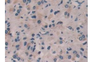 Immunohistochemistry (IHC) image for anti-Interleukin 35 (IL35) (AA 23-219) antibody (ABIN7438589)