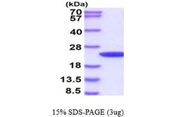 PPIB Protein (AA 26-216)