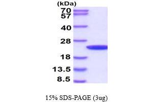 SDS-PAGE (SDS) image for Cyclophilin B (PPIB) (AA 26-216) protein (ABIN666694) (PPIB Protein (AA 26-216))