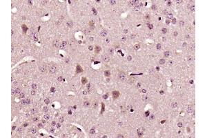 Paraformaldehyde-fixed, paraffin embedded mouse tissue, Antigen retrieval by boiling in sodium citrate buffer (pH6) for 15min, Block endogenous peroxidase by 3% hydrogen peroxide for 30 minutes,  Blocking buffer (normal goat serum) at 37°C for 20min, Antibody incubation with IL-22 Polyclonal Antibody (bs-2623R) at 1:400 overnight at 4°C, followed by a conjugated secondary and DAB staining. (IL-22 antibody  (AA 35-179))