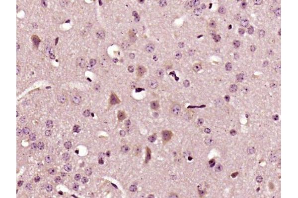 IL-22 antibody  (AA 35-179)