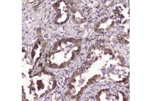 IHC analysis of GLO1 using anti-GLO1 antibody . (GLO1 antibody  (AA 2-184))