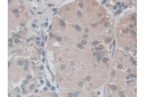 IHC-P analysis of Human Stomach Tissue, with DAB staining. (NOX5 antibody  (AA 456-765))