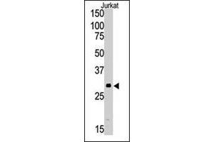 Western blot analysis of SIRT5 polyclonal antibody  in Jurkat cell lysate (35 ug/lane). (SIRT5 antibody  (C-Term))