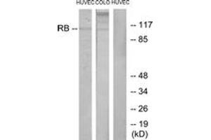 Western blot analysis of extracts from HuvEc/COLO cells, using Retinoblastoma (Ab-795) Antibody. (Retinoblastoma Protein (Rb) antibody  (AA 761-810))