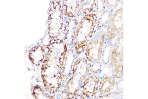 Immunohistochemistry of paraffin-embedded mouse kidney using GLUD1 Rabbit mAb (ABIN7267411) at dilution of 1:100 (40x lens). (GLUD1 antibody)
