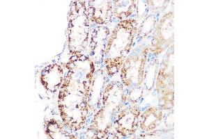 Immunohistochemistry of paraffin-embedded mouse kidney using GLUD1 Rabbit mAb (ABIN7267411) at dilution of 1:100 (40x lens). (GLUD1 antibody)