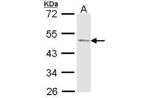 WB Image Sample (30 ug of whole cell lysate) A: Molt-4 , 10% SDS PAGE antibody diluted at 1:1000 (ACPP antibody)