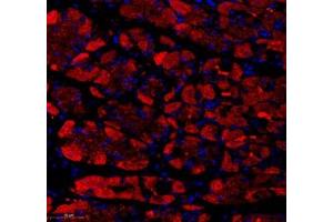 Immunofluorescence of paraffin embedded human stomach using KCTD19 (ABIN7075147) at dilution of 1: 500 (300x lens) (KCTD19 antibody)