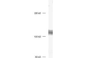 dilution: 1 : 1000, sample: mouse brain honogenate (DLG3 antibody)