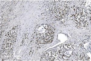 IHC analysis of MCM6 using anti-MCM6 antibody (ABIN7600036).