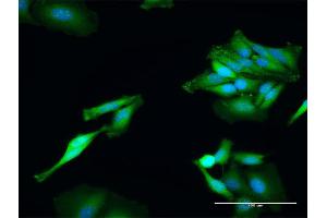 Immunofluorescence of purified MaxPab antibody to TXNRD1 on HeLa cell. (TXNRD1 antibody  (AA 1-497))