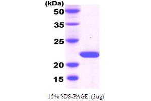 SDS-PAGE (SDS) image for Desert Hedgehog (DHH) (AA 23-198) protein (His tag) (ABIN667084) (desert Hedgehog Protein (AA 23-198) (His tag))