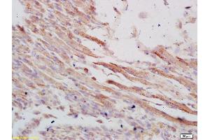 Formalin-fixed and paraffin embedded mouse embryo labeled with Anti-VLDL Polyclonal Antibody, Unconjugated (ABIN705551) at 1:200 followed by conjugation to the secondary antibody and DAB staining (VLDLR antibody  (AA 551-650))