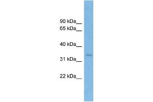 WB Suggested Anti-SSR1 Antibody Titration: 0. (SSR1 antibody  (Middle Region))