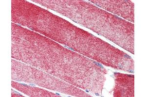 Anti-MAP3K10 / MLK2 antibody IHC staining of human skeletal muscle. (MAP3K10 antibody  (AA 110-138))