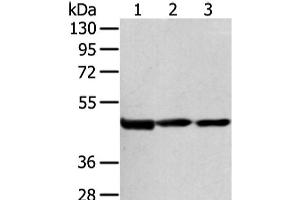 Western Blot analysis of Hela cell and Human bladder carcinoma tissue, Human normal liver tissue using AGPAT9 Polyclonal Antibody at dilution of 1/200 (AGPAT9 antibody)