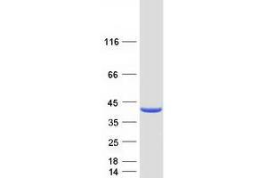 Validation with Western Blot (GALE Protein (Transcript Variant 2) (Myc-DYKDDDDK Tag))