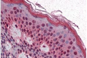 Human Skin (formalin-fixed, paraffin-embedded) stained with SIM1 antibody ABIN364478 at 5 ug/ml followed by biotinylated goat anti-rabbit IgG secondary antibody ABIN481713, alkaline phosphatase-streptavidin and chromogen. (SIM1 antibody)