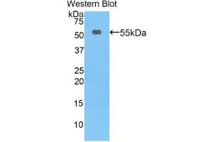 Western blot analysis of the recombinant protein. (Thymidine Phosphorylase antibody  (AA 33-290))