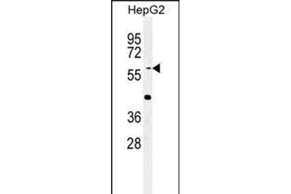 SLC7A6 antibody  (C-Term)