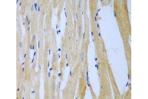 Immunohistochemistry of paraffin-embedded Rat heart using MGAT3 Polyclonal Antibody at dilution of 1:100 (40x lens). (MGAT3 antibody)