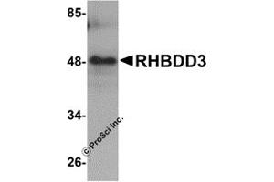 Western Blotting (WB) image for anti-Rhomboid Domain Containing 3 (RHBDD3) (Middle Region) antibody (ABIN1031062) (RHBDD3 antibody  (Middle Region))