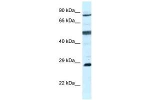 Western Blot showing AK7 antibody used at a concentration of 1 ug/ml against MCF7 Cell Lysate (Adenylate Kinase 7 antibody  (C-Term))