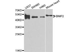 Western Blotting (WB) image for anti-BCL2/adenovirus E1B 19kDa Interacting Protein 2 (BNIP2) antibody (ABIN1980298) (BNIP2 antibody)