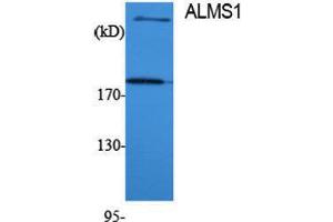 Western Blotting (WB) image for anti-Alstrom Syndrome 1 (ALMS1) (Internal Region) antibody (ABIN3183254)