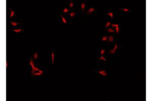 ABIN6269000 staining Jurkat  cells by IF/ICC. (Cyclin E2 antibody  (C-Term))