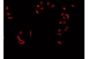ABIN6269000 staining Jurkat  cells by IF/ICC.