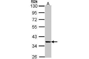 WB Image Sample (30 ug of whole cell lysate) A: A431 , 10% SDS PAGE antibody diluted at 1:1000