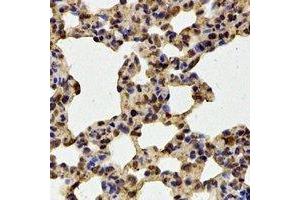 Immunohistochemical analysis of HOS staining in mouse lung formalin fixed paraffin embedded tissue section. (T-Box 5 antibody)
