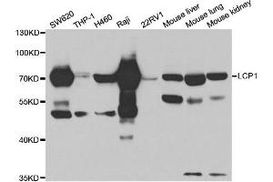 Western Blotting (WB) image for anti-Lymphocyte Cytosolic Protein 1 (LCP1) antibody (ABIN1876741) (LCP1 antibody)