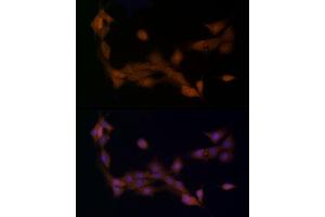 Immunofluorescence analysis of PC-12 cells using Ube2L3 / UBCH7 Rabbit mAb (ABIN7271178) at dilution of 1:25 (40x lens). (UBE2L3 antibody)