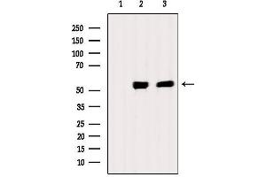 Western blot analysis of extracts from various samples, using Chk1 Antibody. (CHEK1 antibody)