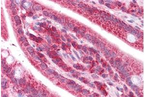 Human Small Intestine: Formalin-Fixed, Paraffin-Embedded (FFPE) (TST antibody  (AA 101-150))