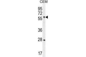 Western blot analysis in CEM cell line lysates (35ug/lane) using DLK1  Antibody . (DLK1 antibody)