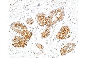 anti-serine Hydroxymethyltransferase 1 (Soluble) (SHMT1) (AA 453-483) antibody