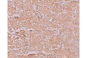 Immunohistochemical staining of mouse liver cells with SLC39A14 polyclonal antibody  at 2.
