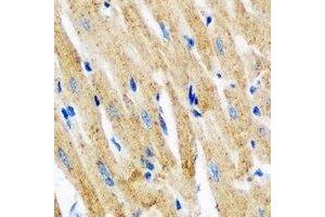 Immunohistochemical analysis of Tropomyosin 3 staining in mouse heart formalin fixed paraffin embedded tissue section. (TPM3 antibody)