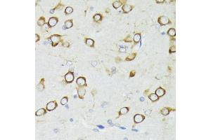 Immunohistochemistry of paraffin-embedded rat brain using PDPK1 antibody (ABIN3022351, ABIN3022352, ABIN3022353, ABIN1681308 and ABIN6218755) at dilution of 1:200 (40x lens). (PDPK1 antibody  (AA 150-429))
