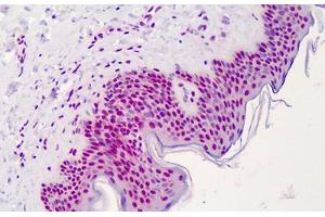 Human Skin: Formalin-Fixed, Paraffin-Embedded (FFPE) (APEX1 antibody)