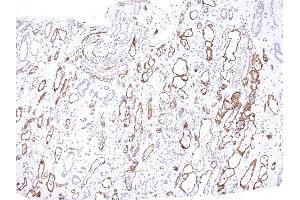 Formalin-fixed, paraffin-embedded human Kidney Transplant stained with Complement 4d Mouse Monoclonal Antibody (C4D204). (C4A antibody)
