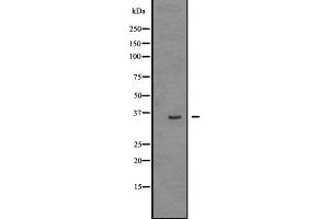Western blot analysis of TRIO expression in HEK293 cells ,The lane on the left is treated with the antigen-specific peptide.