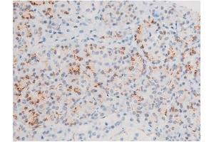 Immunohistochemistry (IHC) image for anti-GATA Binding Protein 4 (GATA4) (pSer105) antibody (ABIN6256094)