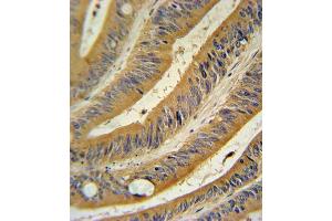 Immunohistochemistry (IHC) image for anti-Wingless-Type MMTV Integration Site Family, Member 10B (WNT10B) antibody (ABIN3002706) (WNT10B antibody)
