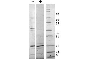 SDS-PAGE of Human TRAIL Recombinant Protein SDS-PAGE of Human TRAIL Recombinant Protein. (TRAIL Protein)